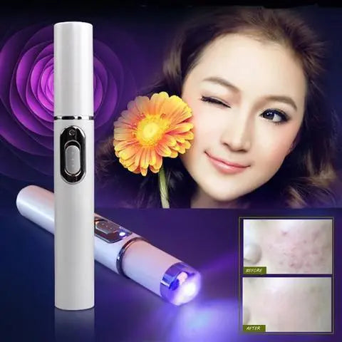 Blue Light Therapy Acne Laser Pen Soft Scar Wrinkle Removal Treatment Device Skin Care Beauty Equipment Melissa